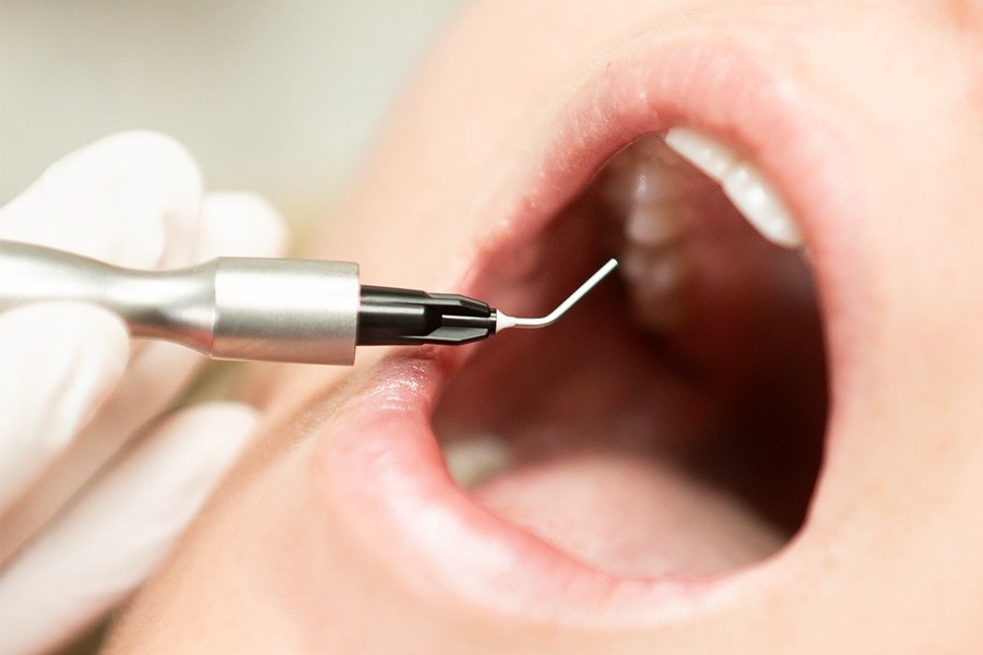 Ozone therapy